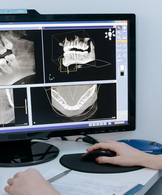 CBCT Use and DRL